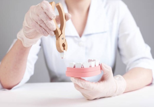 拔智齒的洞黑黑的、白白的是怎麽回事？掌握智齒洞清潔指南