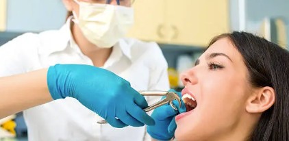 拔牙後一定要植牙嗎？拔牙不植牙會怎樣？一文了解潛在危害