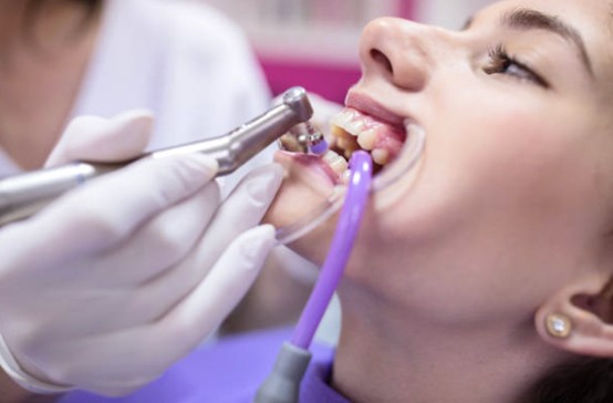 洗牙邊間好？2026年香港10間平靚正洗牙推薦