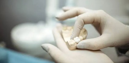 植牙會痛嗎？痛多久？快速了解植牙手術時間＆全過程介紹