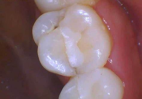 屯門牙醫邊間好