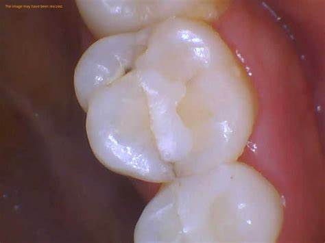 屯門牙醫邊間好