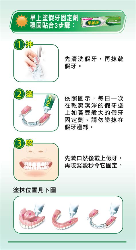 假牙固定劑推薦假牙日常佩戴與固定劑選購示意圖片