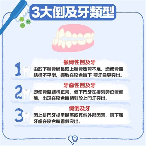 倒及牙面相 倒及牙類型