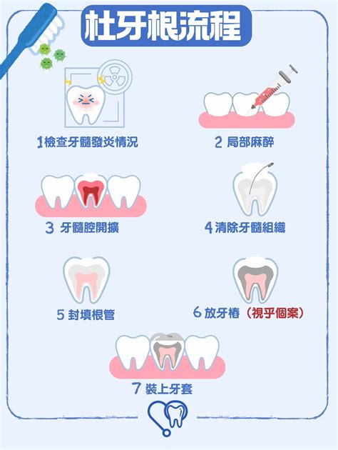 牙齒神經痛根管治療完整流程說明