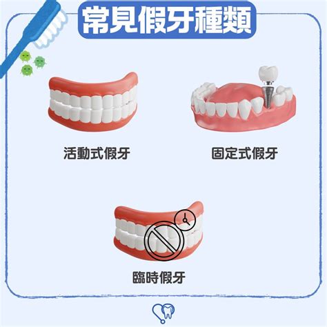 全副假牙價錢詳解與牙醫諮詢模型示意圖