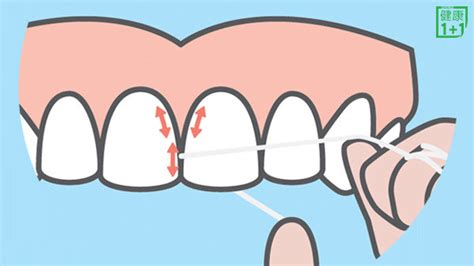 牙齦肉掀起來怎麼辦